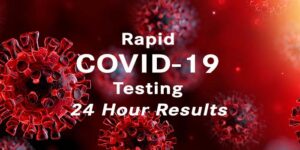 COVID 19 testing CHP